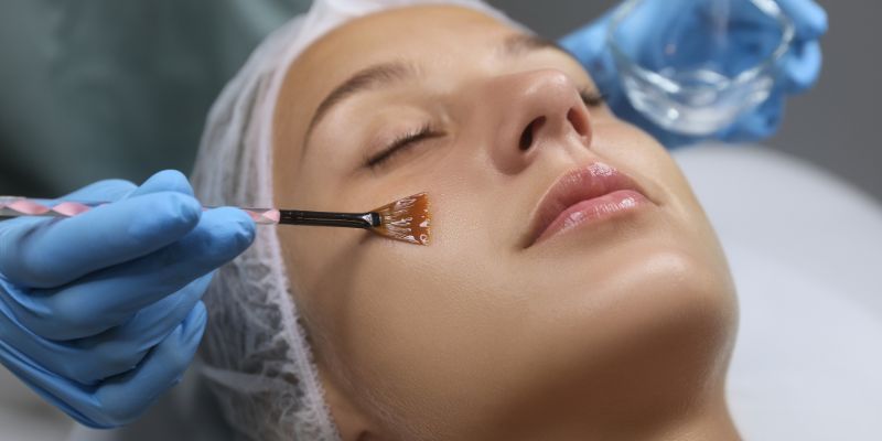 chemical peel in kolkata