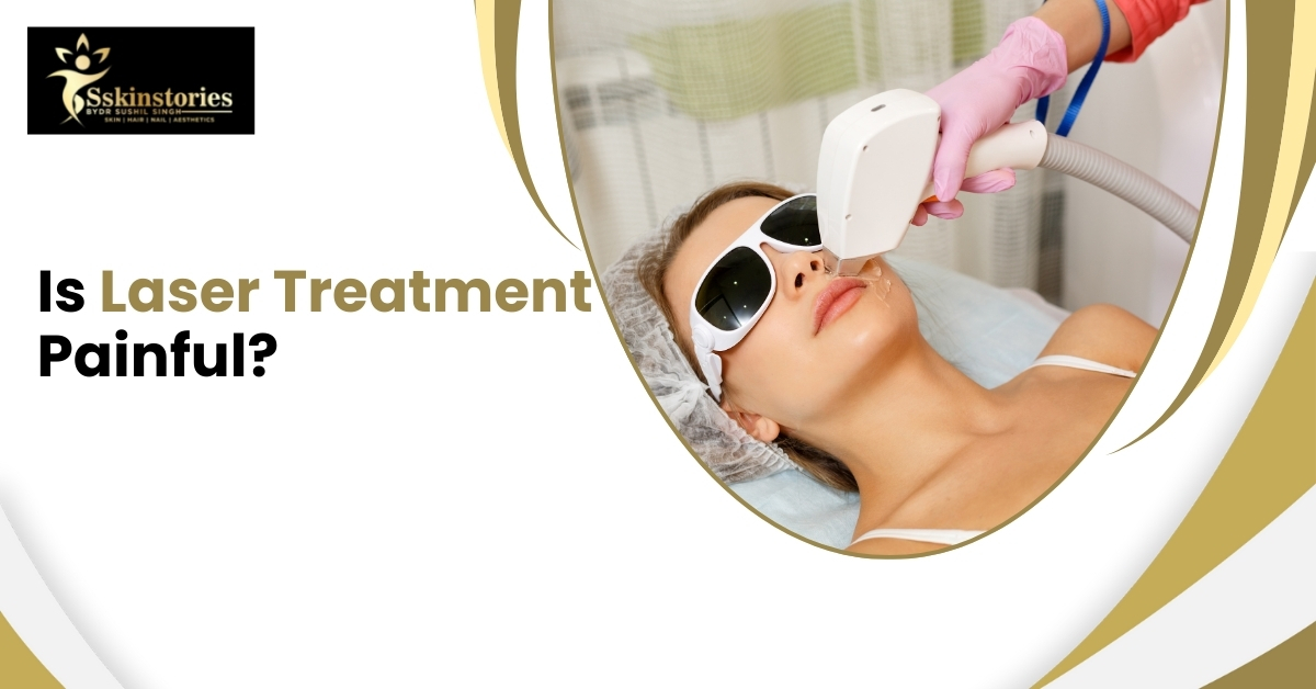 Laser treatment