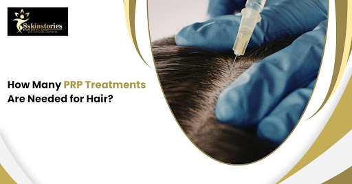 PRP Treatments