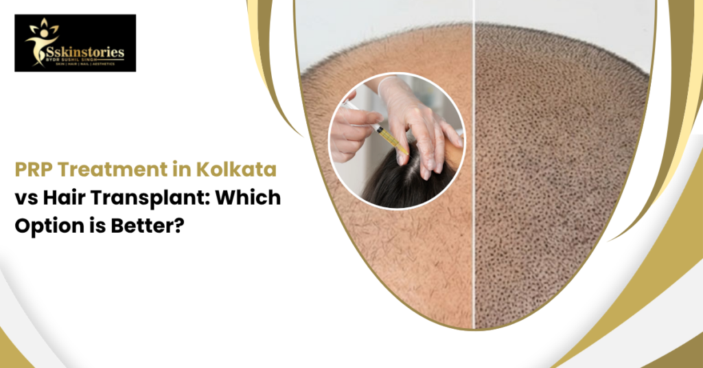 PRP Treatment in Kolkata