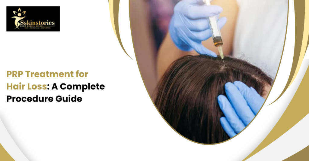 PRP Treatment for Hair Loss